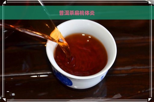 普洱茶扁桃体炎