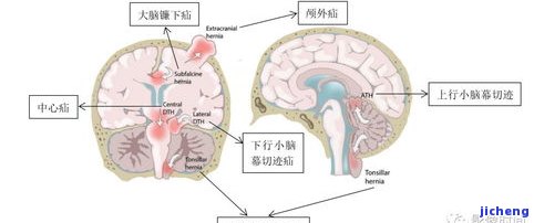 玉镯内部结构详解：图解蛛网状构造与松散特性