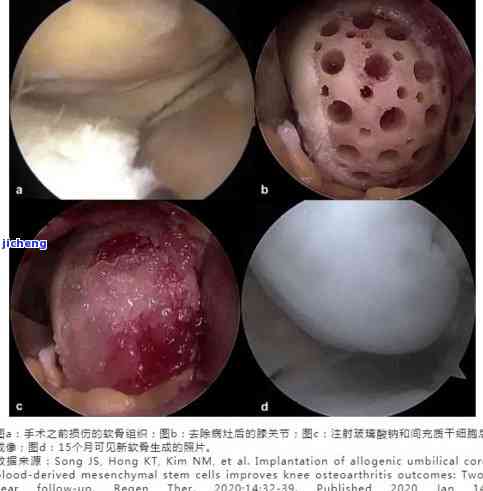 茄子玉吊坠寓意是什么-茄子玉吊坠寓意是什么