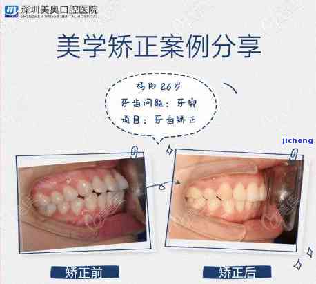 鸿寿春普洱茶价格表，最新鸿寿春普洱茶价格表，一目了然！