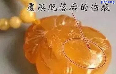 蜜蜡覆膜能彻底清除吗？查看去除过程视频与图片