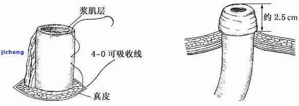 纹裂与棉线有何区别？对比图解解析