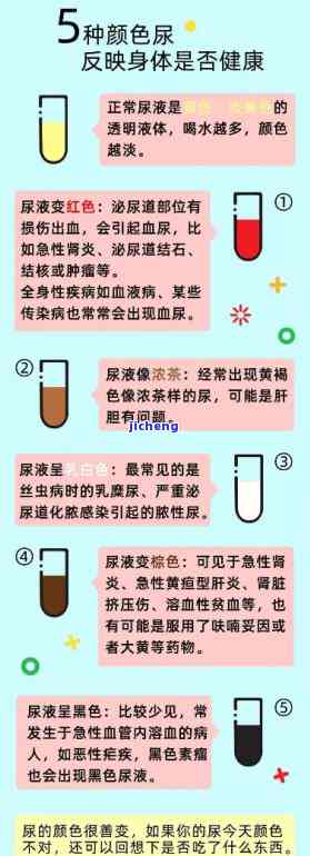 晨尿颜色像红茶味道大，异常晨尿：颜色如红茶，味道大？需警惕肾脏疑问！