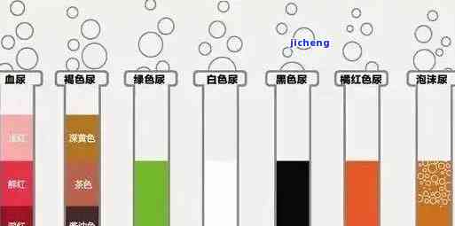 小便颜色像红茶-小便颜色像红茶一样是有什么原因