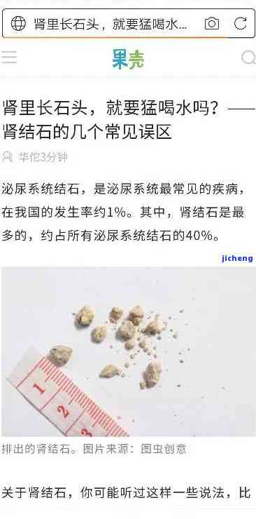 结石喝什么茶消除最快？寻找最有效的解决方案