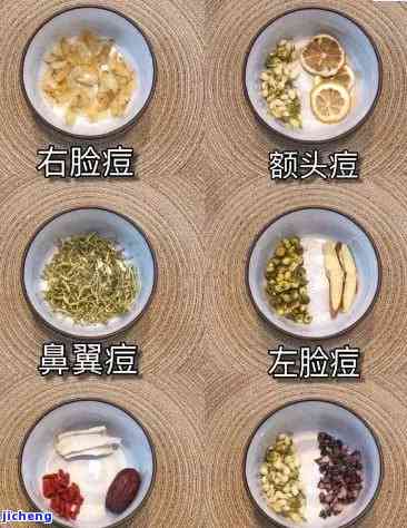 痘痘多喝什么茶？解决痘痘疑问的有效饮品推荐